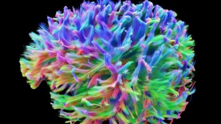 Esta es la imagen más precisa del mundo sobre el cableado del cerebro humano y su función, que se muestra según el tipo de color. 