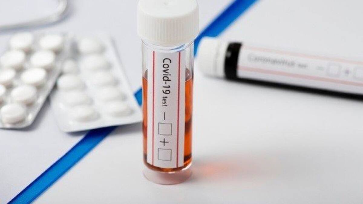 El test de antígeno de covid empezará a emplearse en el Bierzo-Laciana a principios de octubre