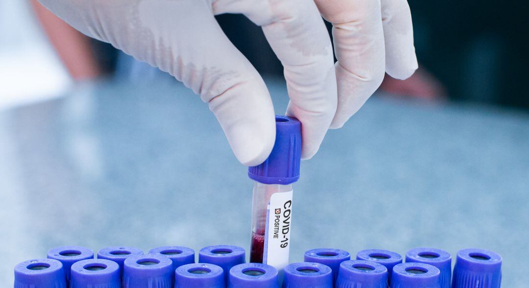 Castilla y León ha comunicado 35 casos nuevos