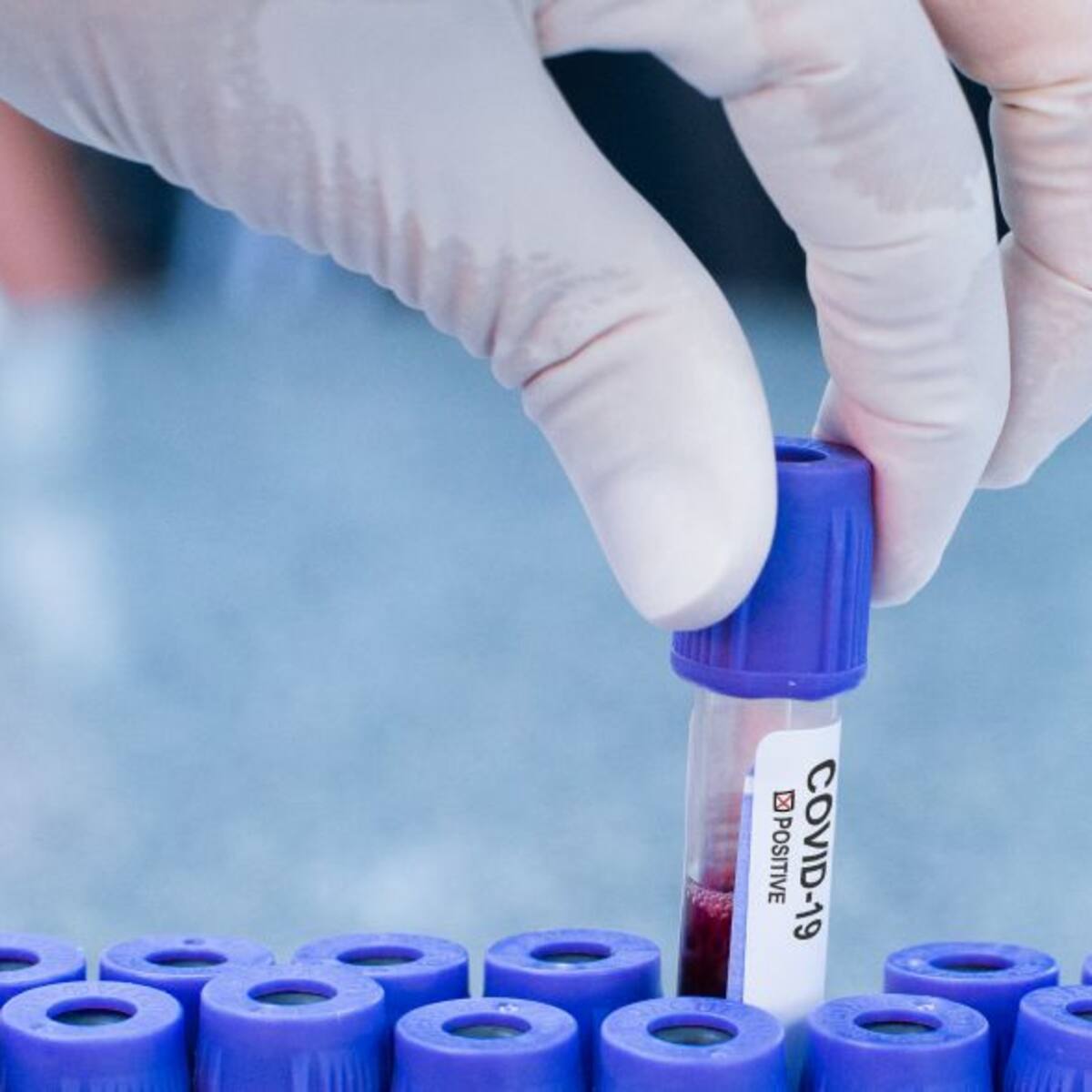 Castilla y León suma 35 nuevos casos y ningún fallecido