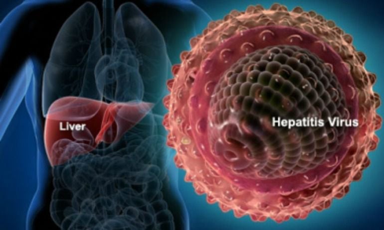 Fotografía de recurso de la actuación de la Hepatitis C