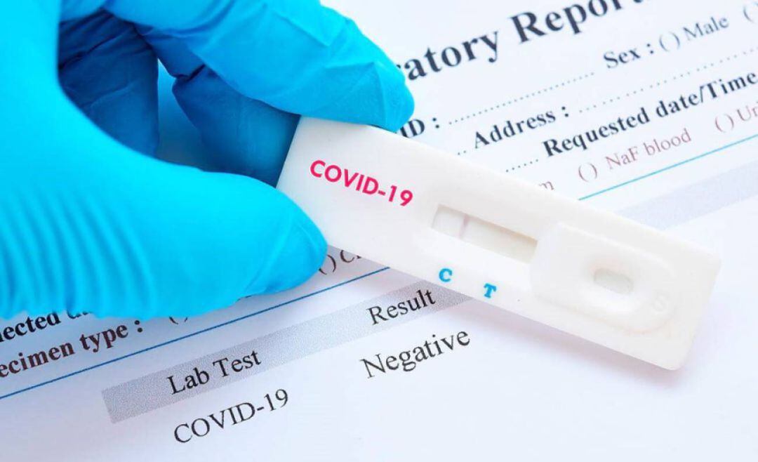 Test de detección del coronavirus