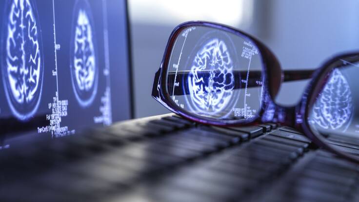 Entrevista a José López Atalaya sobre los 12 avances del Instituto de Neurociencias del 2020