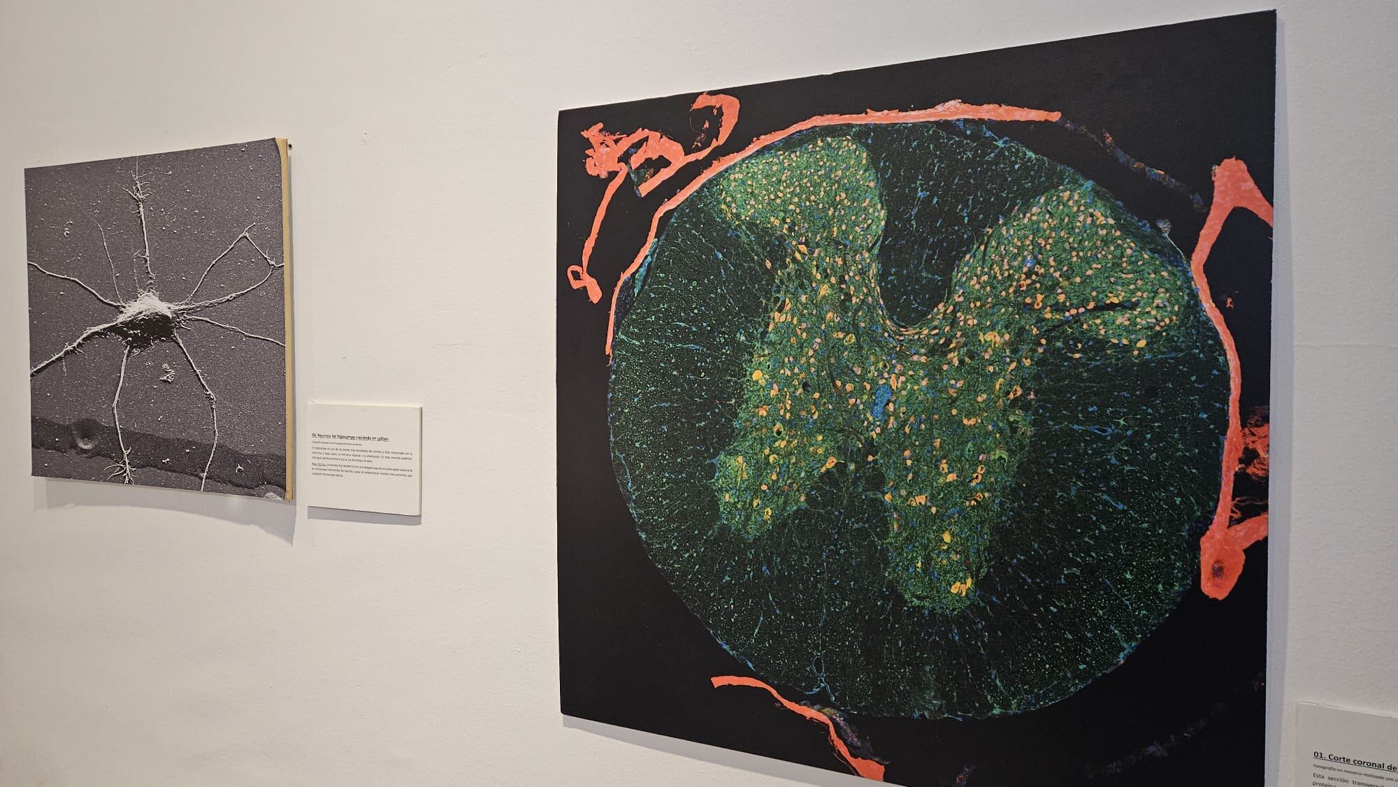 Otra de las obras de la exposición 'Medularte'