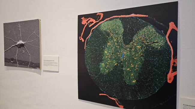 Otra de las obras de la exposición 'Medularte'