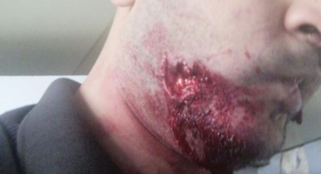 El hombre ha sido atendido por los servicios médicos.