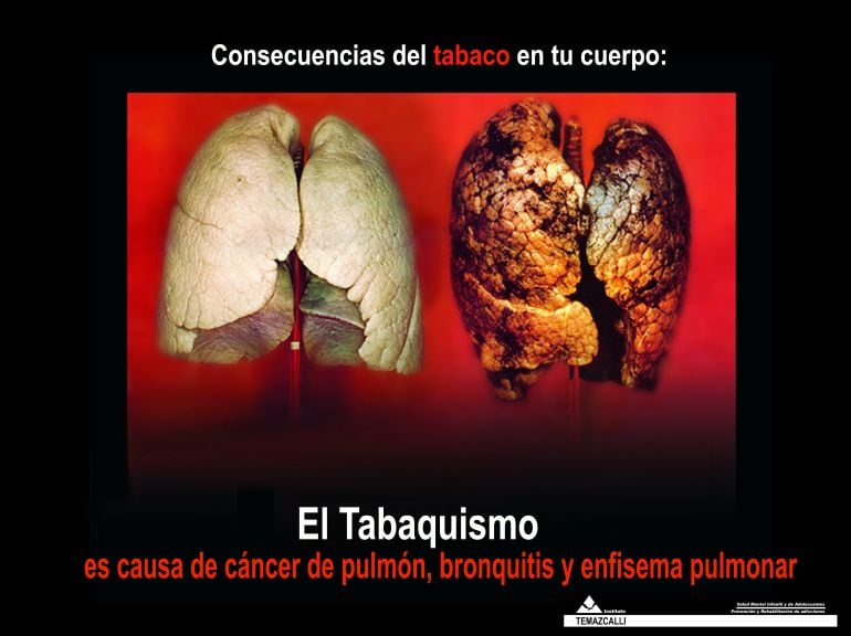 imagenes que aparecen en las cajetillas de tabaco con la nueva normativa