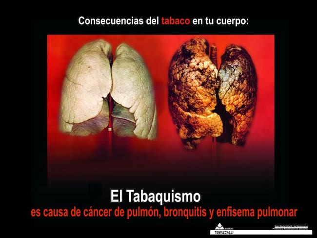 imagenes que aparecen en las cajetillas de tabaco con la nueva normativa