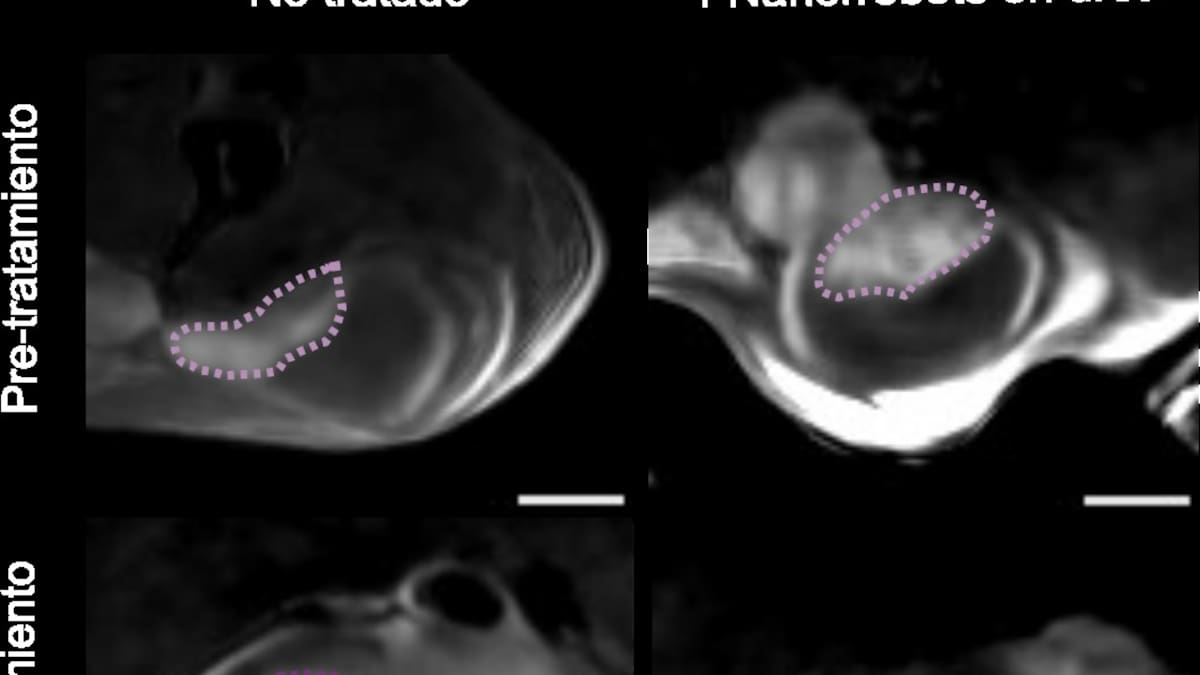 Jordi LLop: "Ganamos eficacia terapéutica y tiempo de tratamiento"