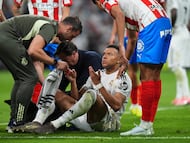 Kylian Mbappé tras un golpe en la frente