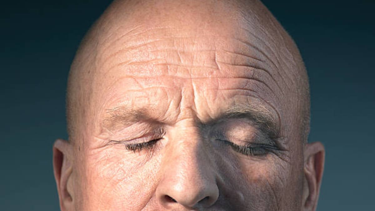 El inventor de la tragedia griega murió por culpa de su calva