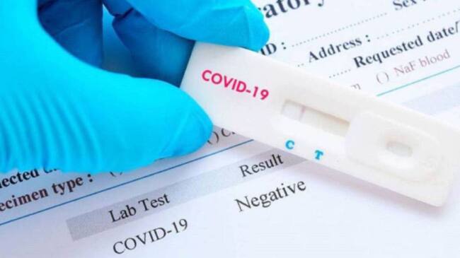 Test de Covid