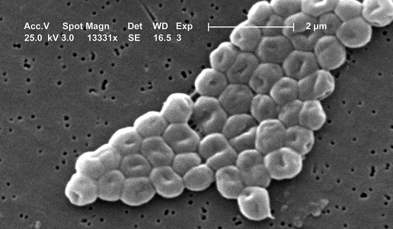 La OMS propone &quot;prioridad crítica&quot; para encontrar nuevas armas para hacer frente a la bacteria Acinetobacter baumannii.