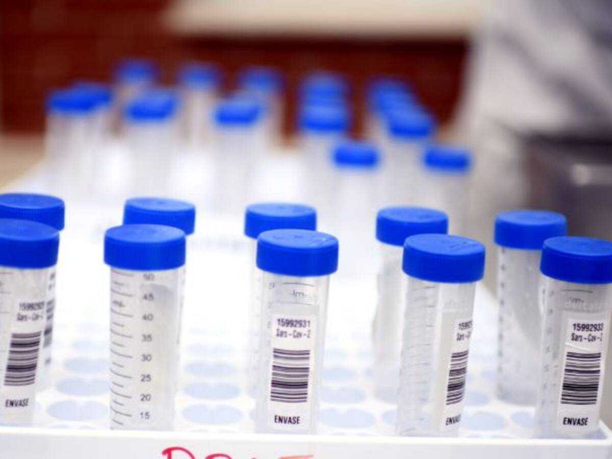 Extremadura registra 404 casos positivos y 2 fallecidos por Covid-19