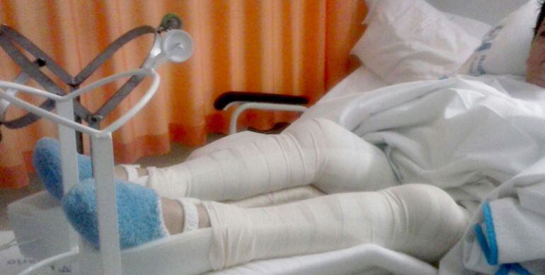 Mercedes, residente de Moscatelares, tras romperse las rodillas