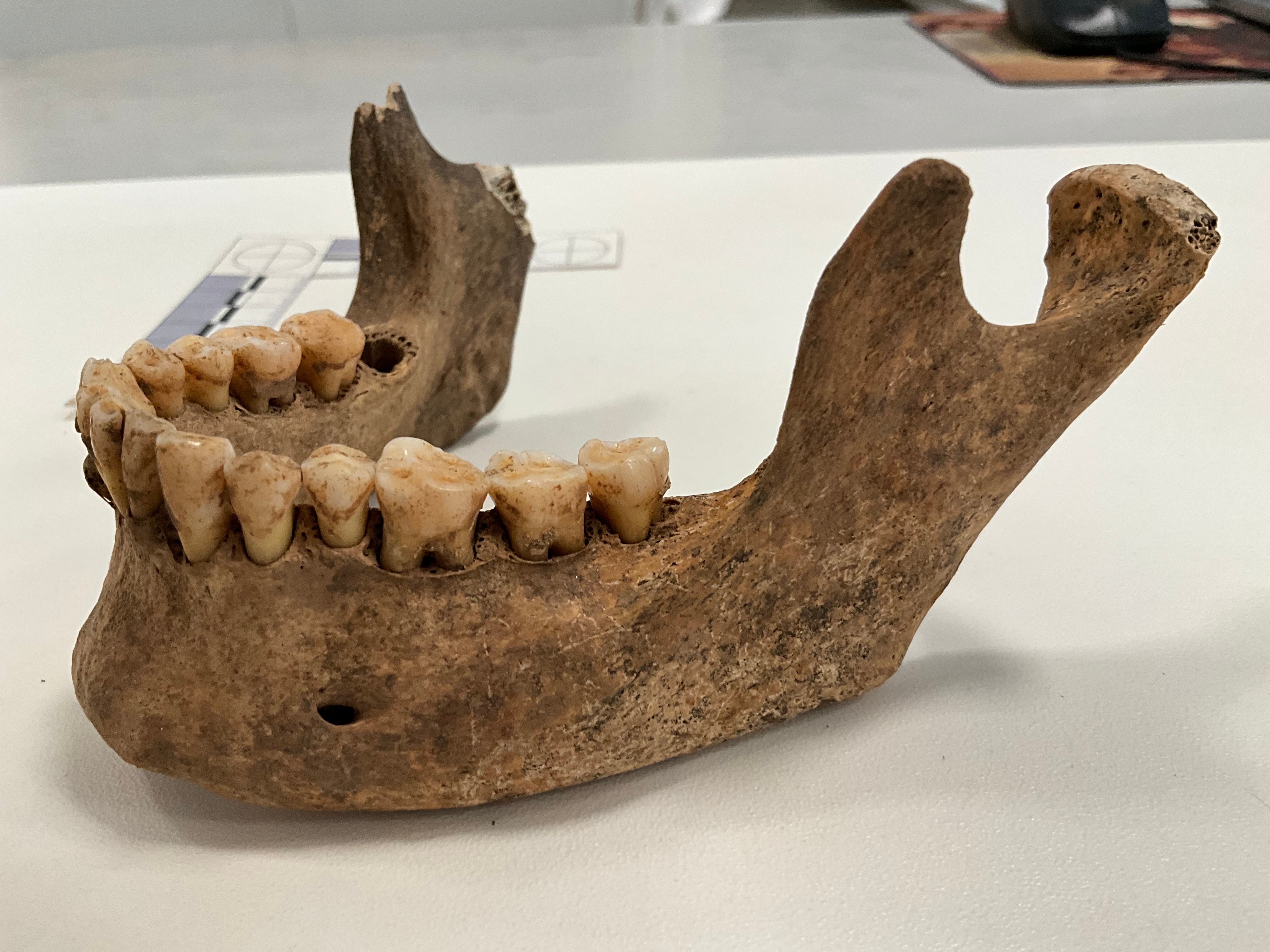 Una de las muestras que se ha analizado en unos de los enterramientos fenicios de Málaga