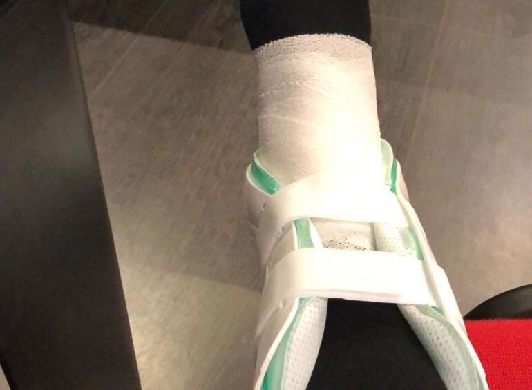 El tobillo de Neymar, en la mañana de este lunes