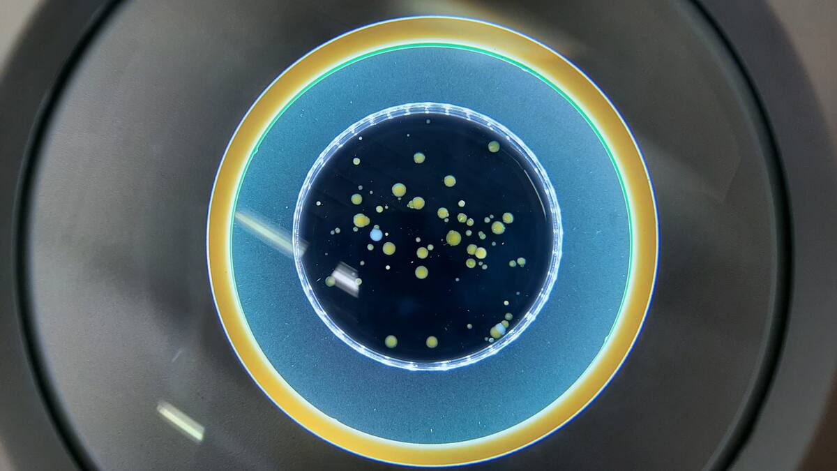 Salud Pública en Aragón: así se vigila el agua y la comida desde el laboratorio - Hora 14 Aragón (04/02/2024)