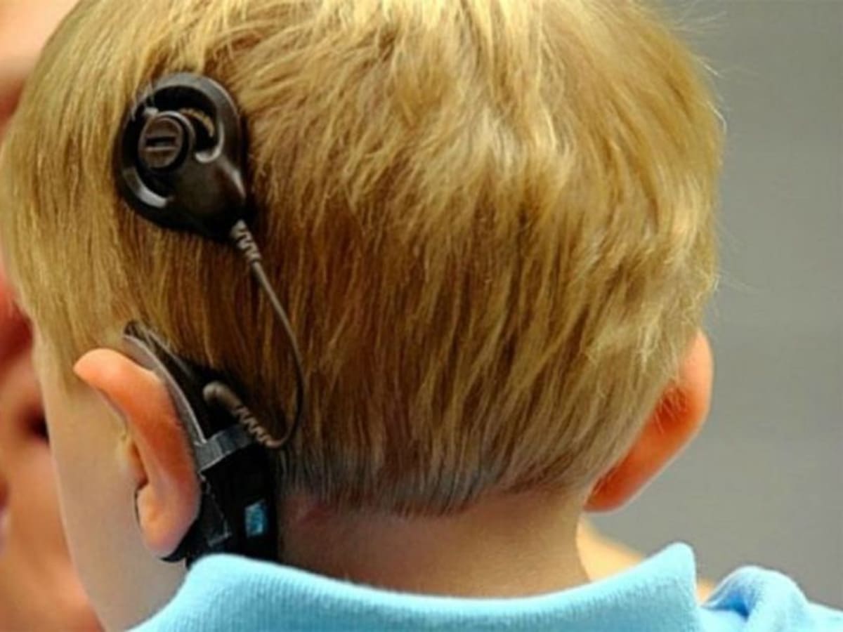 ¿Cómo escuchan las personas que no pueden oír?