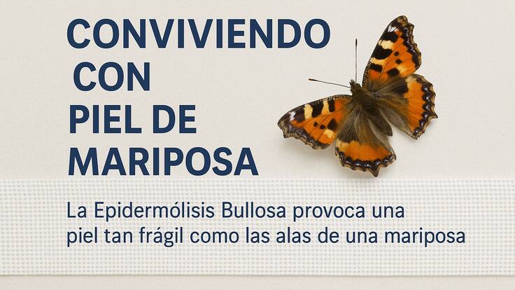 Entrevista a Ana Llopis sobre la enfermedad de 'piel de mariposa'