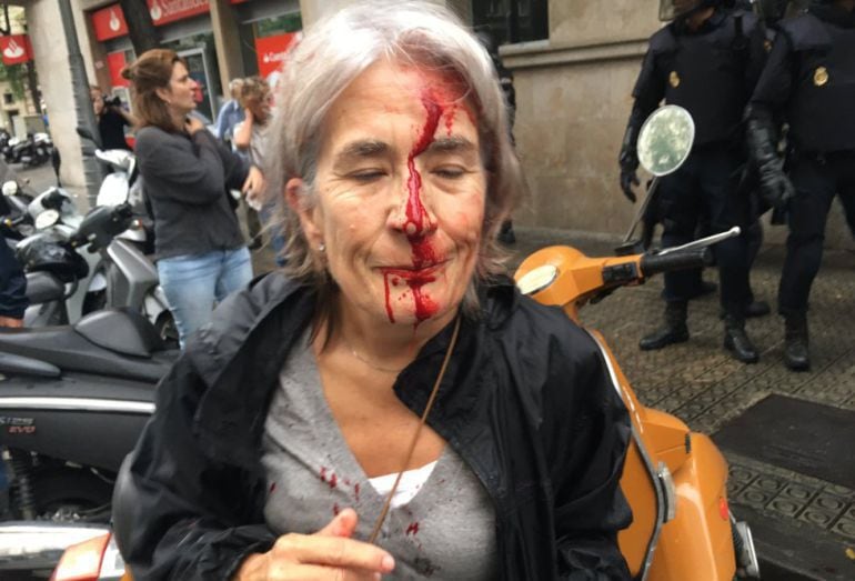 Mujer herida a las puertas de la escuela Infant Jesús de Barcelona, el 1 de octubre.