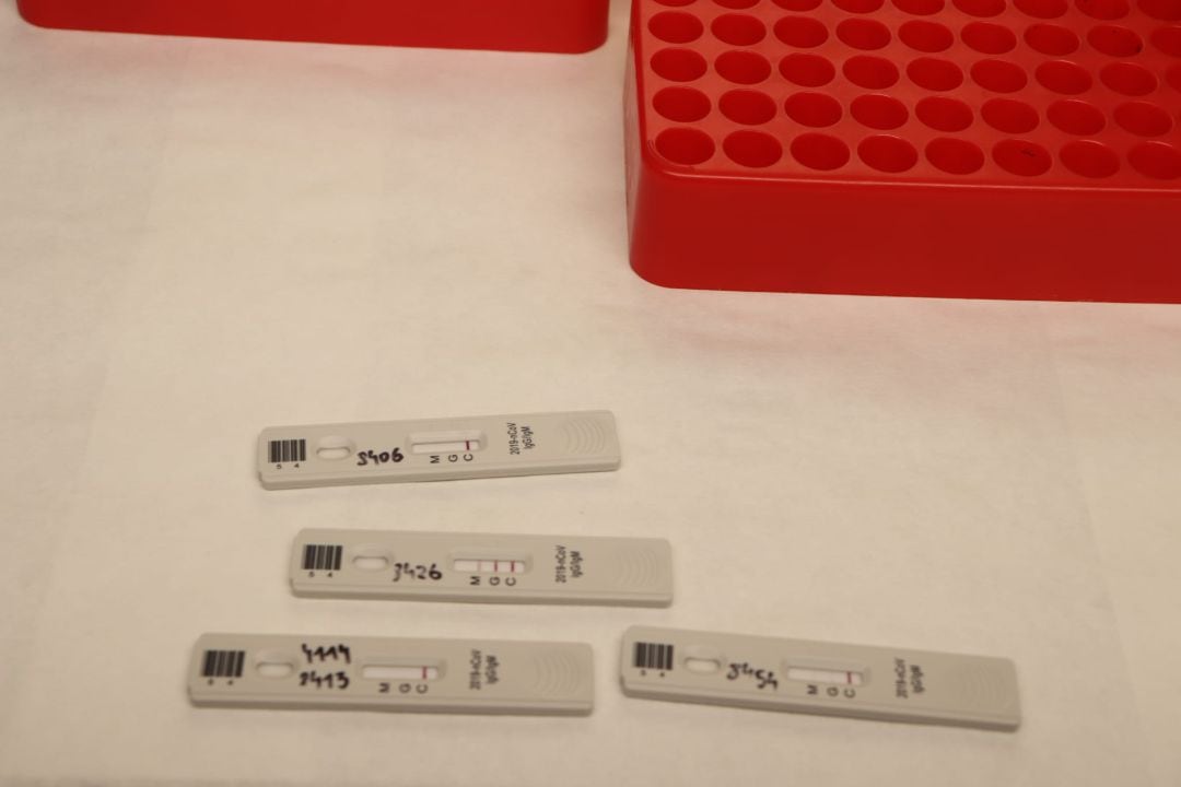 Las Pitiusas han sumado 28 postivos más por coronavirus