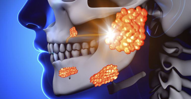 El cas de Neymar ha posat el focus sobre aquesta malaltia