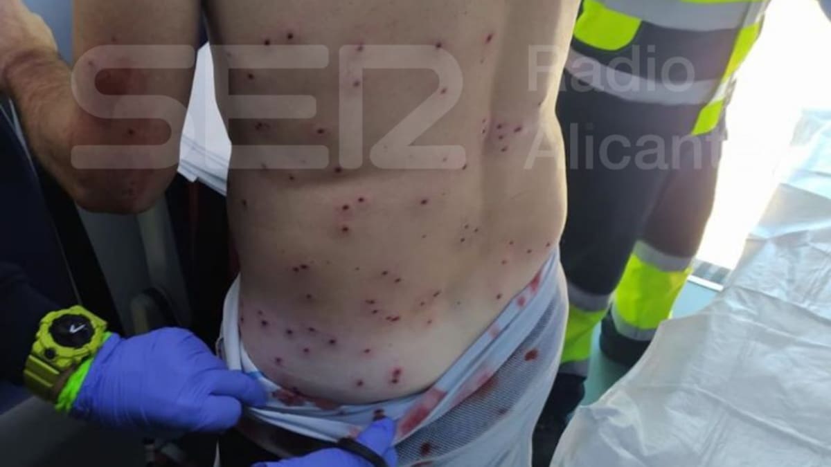 Un cazador dispara a un ciclista al confundirlo con un conejo