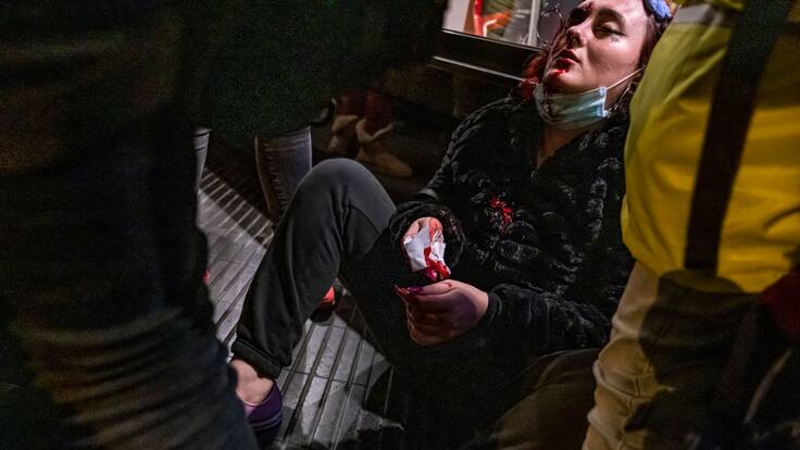 ENTREVISTA Laia, testimoni dels aldarulls on una noia va perdre l'ull