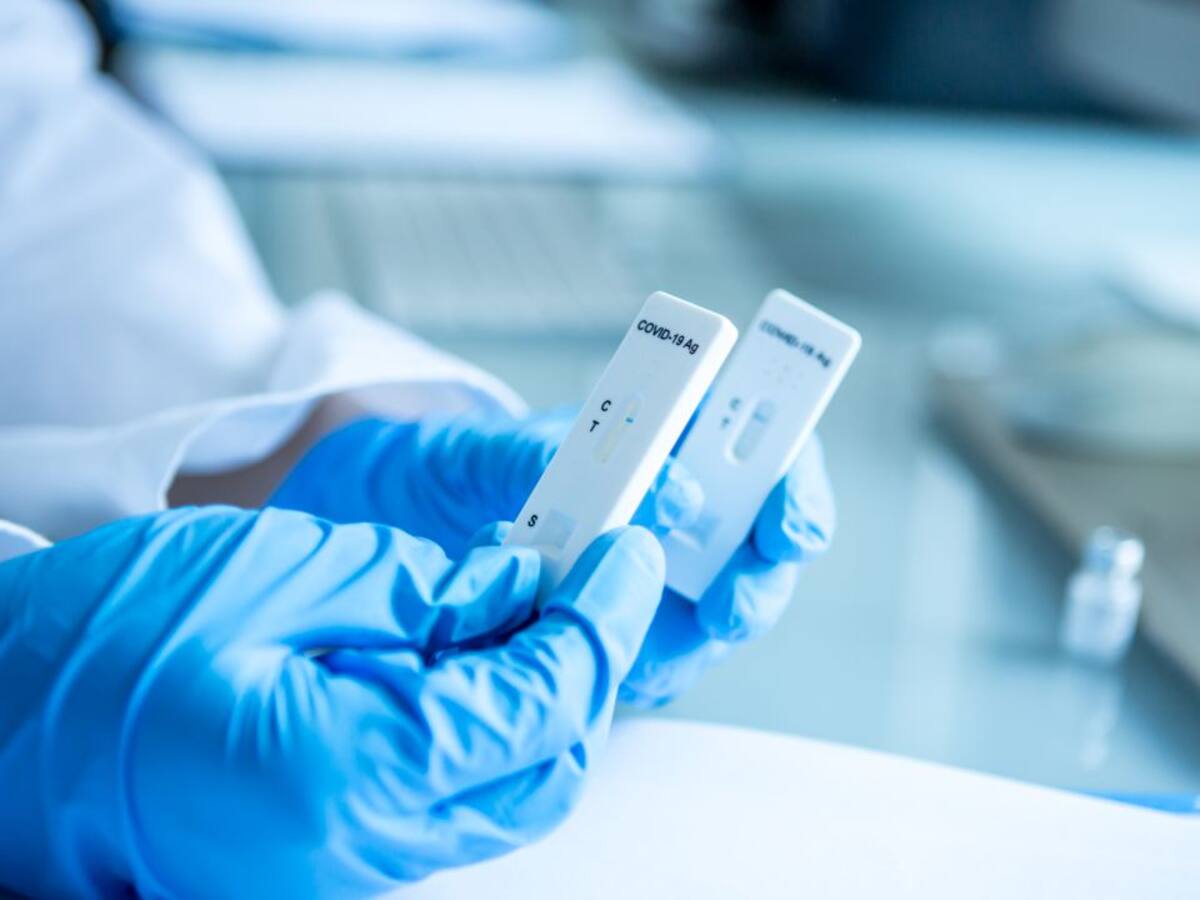 Pruebas de antígenos gratuitas para los vecinos de Quer por cortesía del Ayuntamiento