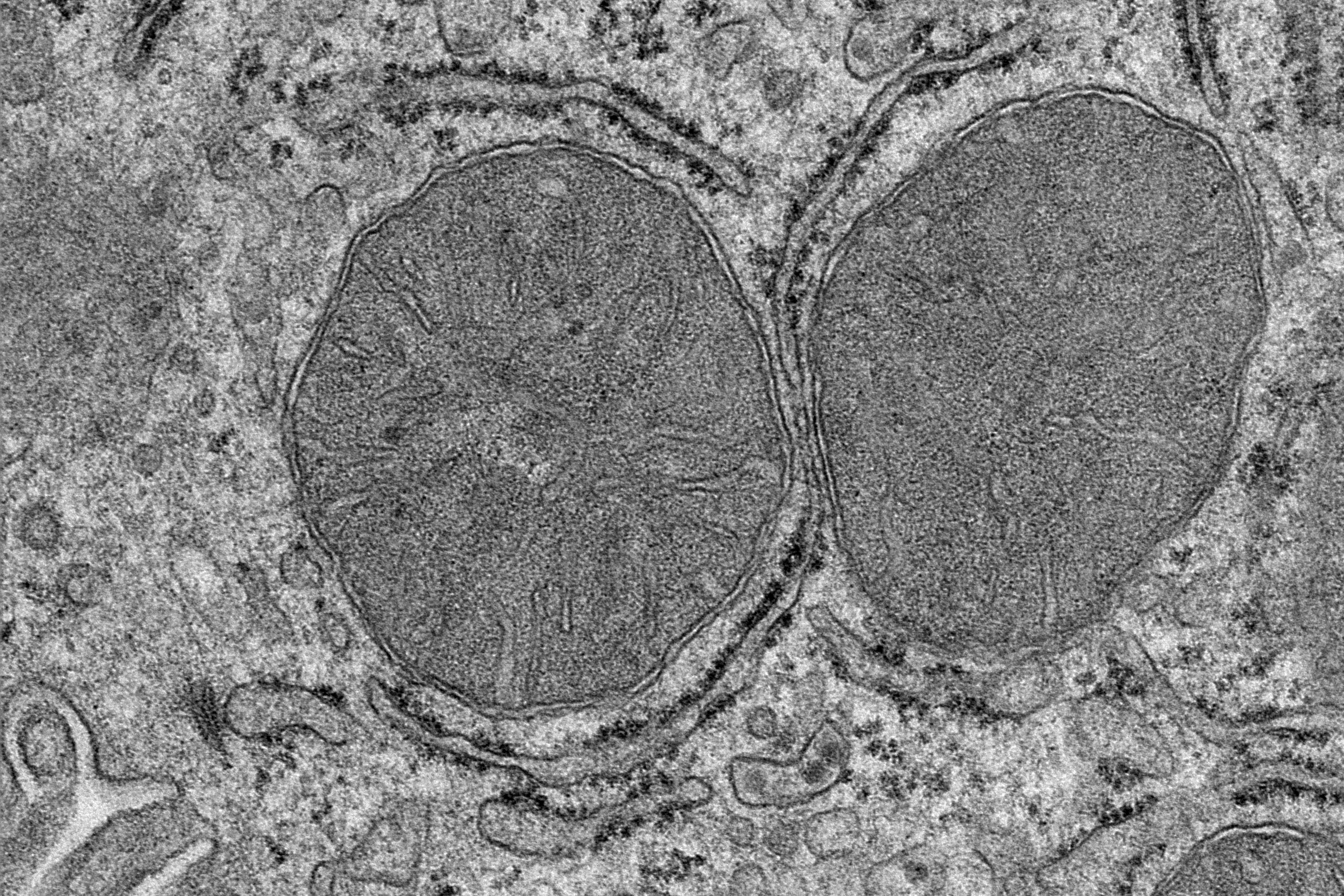 Las mitocondrias en el hígado cambian de forma tan pronto como se percibe el alimento. La imagen muestra una micrografía electrónica de las mitocondrias en las células hepáticas.
CRÉDITO S. Henscke/Instituto Max Planck para la Investigación del Metabolismo