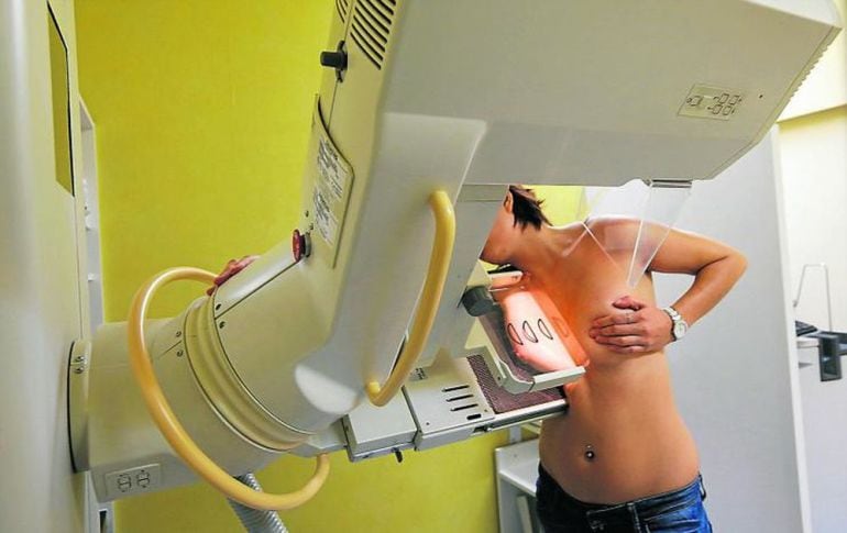 El 54% dels càncers de mama es diagnostiquen amb els programes de cribatge