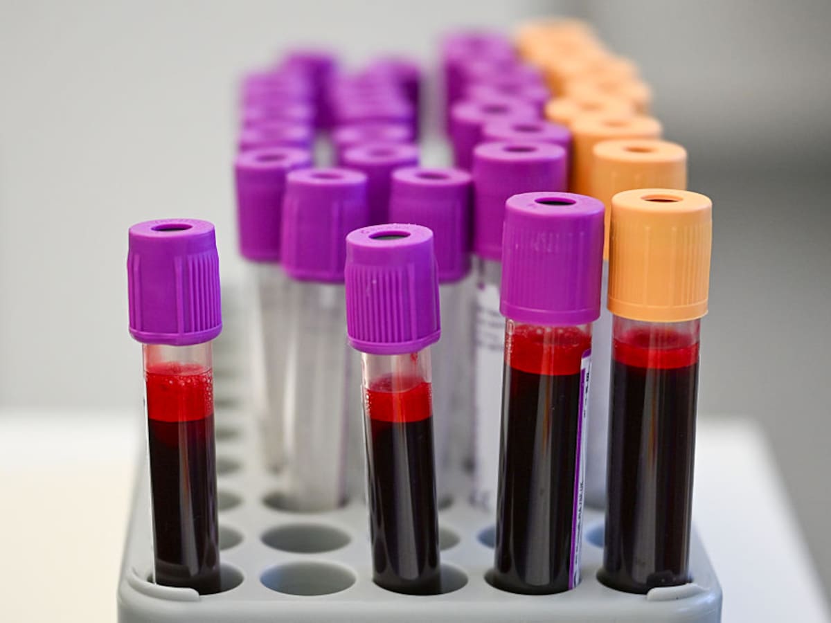 HLA Los Naranjos acoge la jornada ‘Donar sangre, es dar vida’