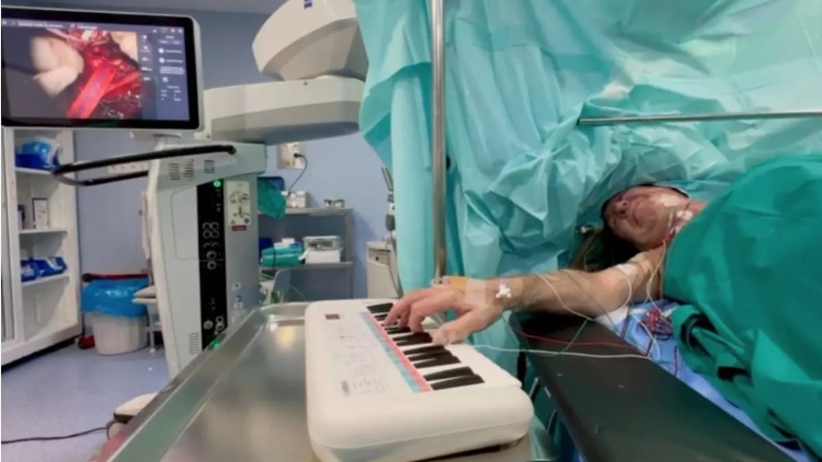 Así fue la operación de Miguel:Tocando el piano mientras le extirpan un tumor