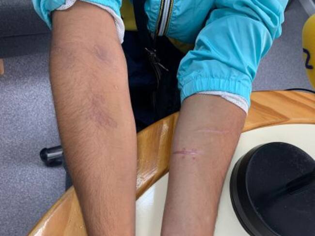 Toufik muestra los cortes en los brazos que le hizo el mismo hombre que le propinó una pedrada en la cabeza.