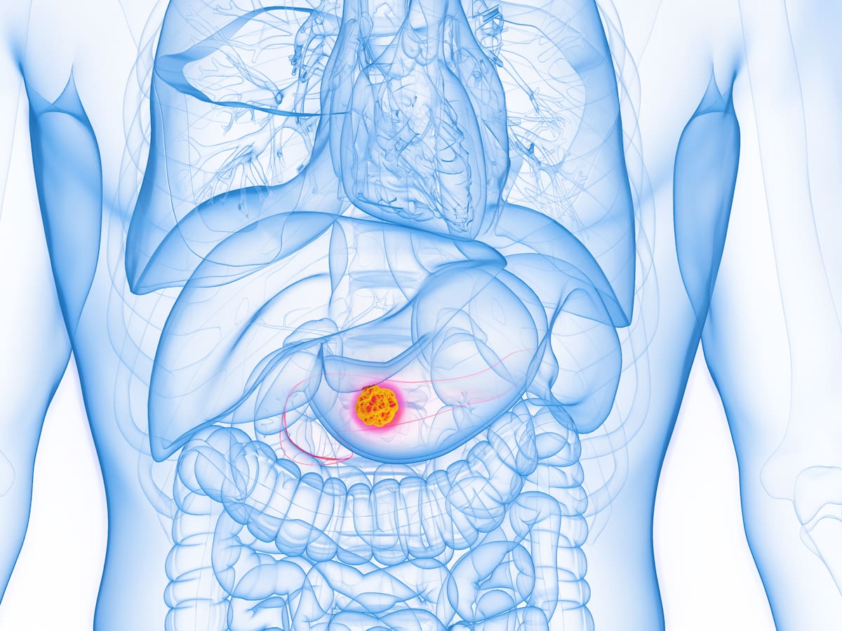 La tajante opinión de dos expertos sobre la cura del cáncer de páncreas de Barbacid: "Hay un conflicto de intereses"