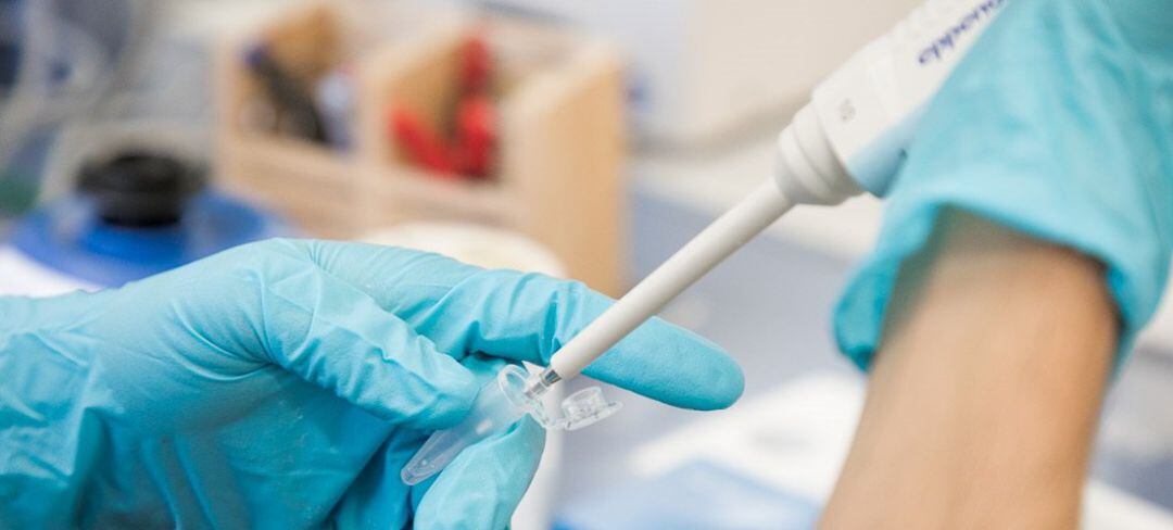 Archivo - Análisis de una prueba PCR.