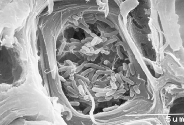 Fotografía de Xylella fastidiosa al microscopio electrónico de barrido. La barra blanca de escala corresponde a 5 micras (1:200 de milímetro)