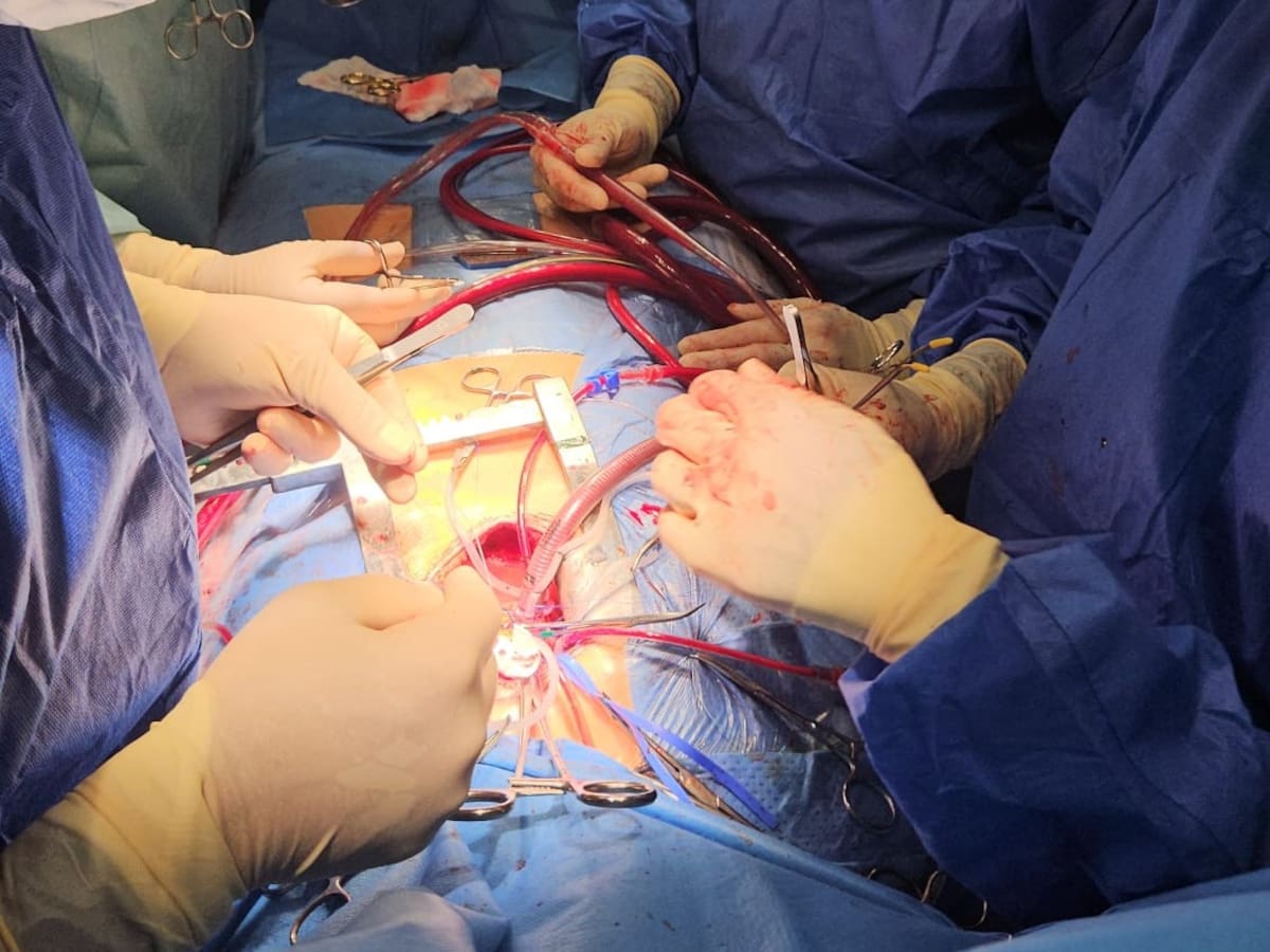 El corazón en pausa para salvar una vida: así es una operación cardíaca en el Hospital Doctor Negrín