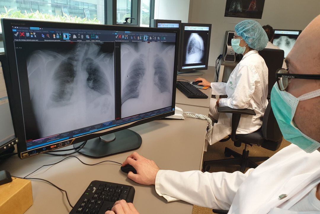 Varios profesionales sanitarios comprueban unas radiografías.