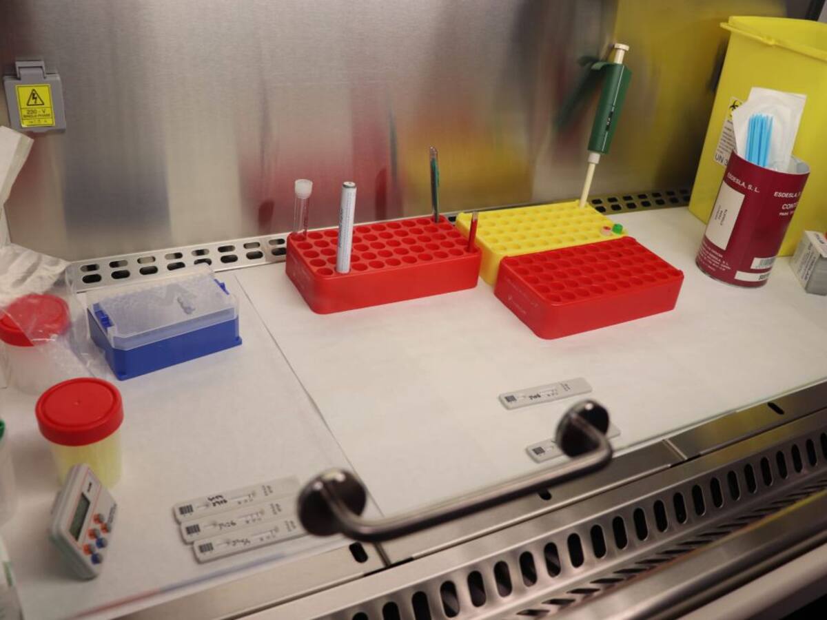 Fallece un hombre de 76 años con coronavirus que estaba ingresado en la UCI de Can Misses