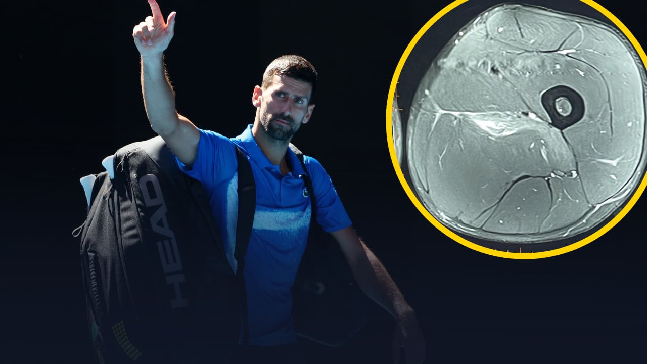 Novak Djokovic publica la imagen de su resonancia tras abandonar en el Open de Australia