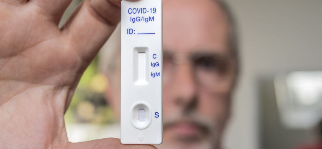 Los test de antígenos ofrecen resultados más rápidos que las PCR.