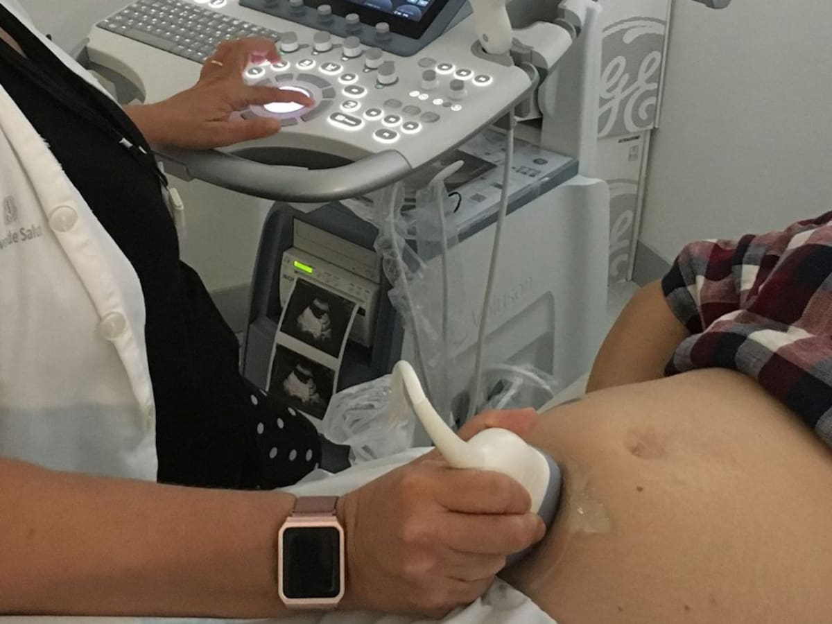 El Mateu Orfila fa més cesàries de les recomanables