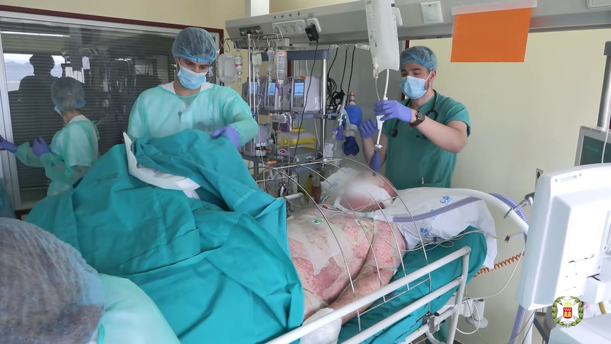 Charlamos con Puri Holguín, una de las responsables de la Unidad de grandes quemados y jefa de Servicio de Cirugía Plástica en el Hospital U. de Getafe