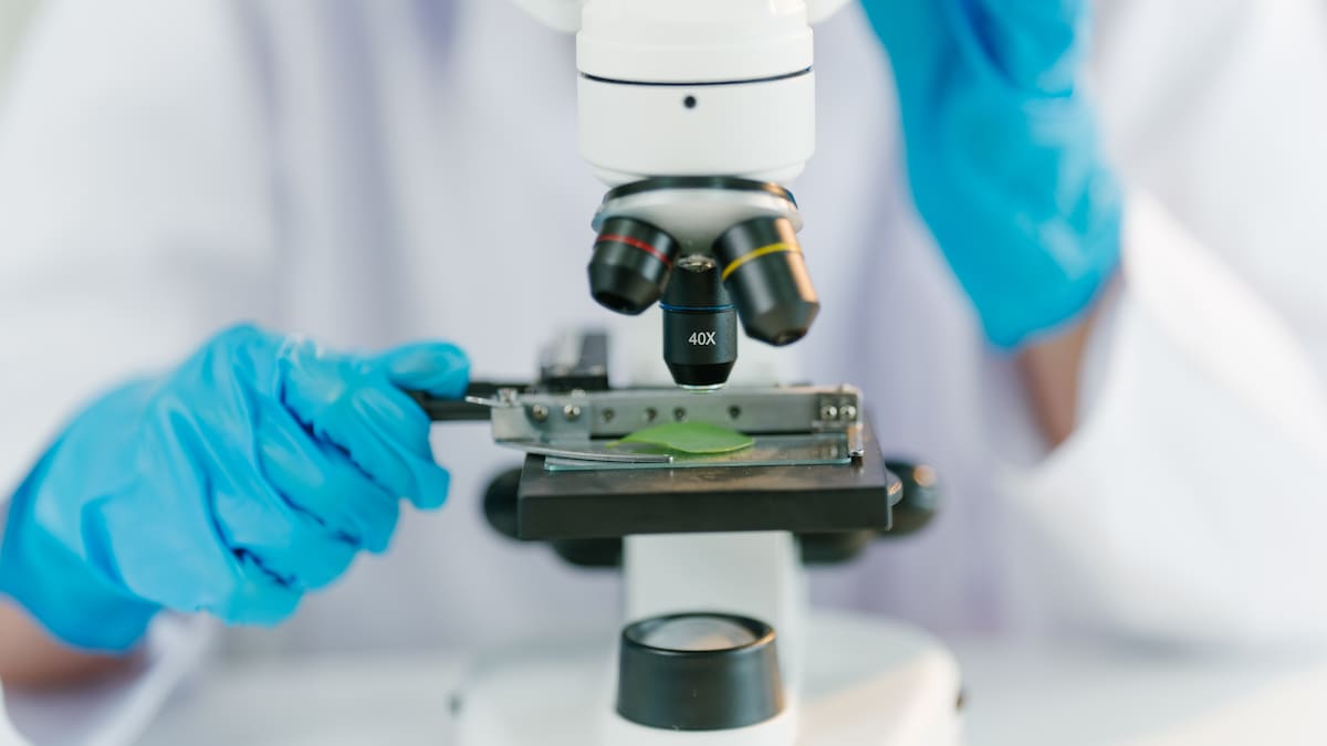 Logran curar el VIH a un paciente alemán con un trasplante de células madre