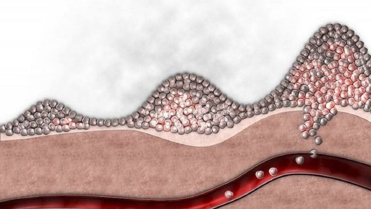 El Blog de la Ciencia; Un avance esperanzador