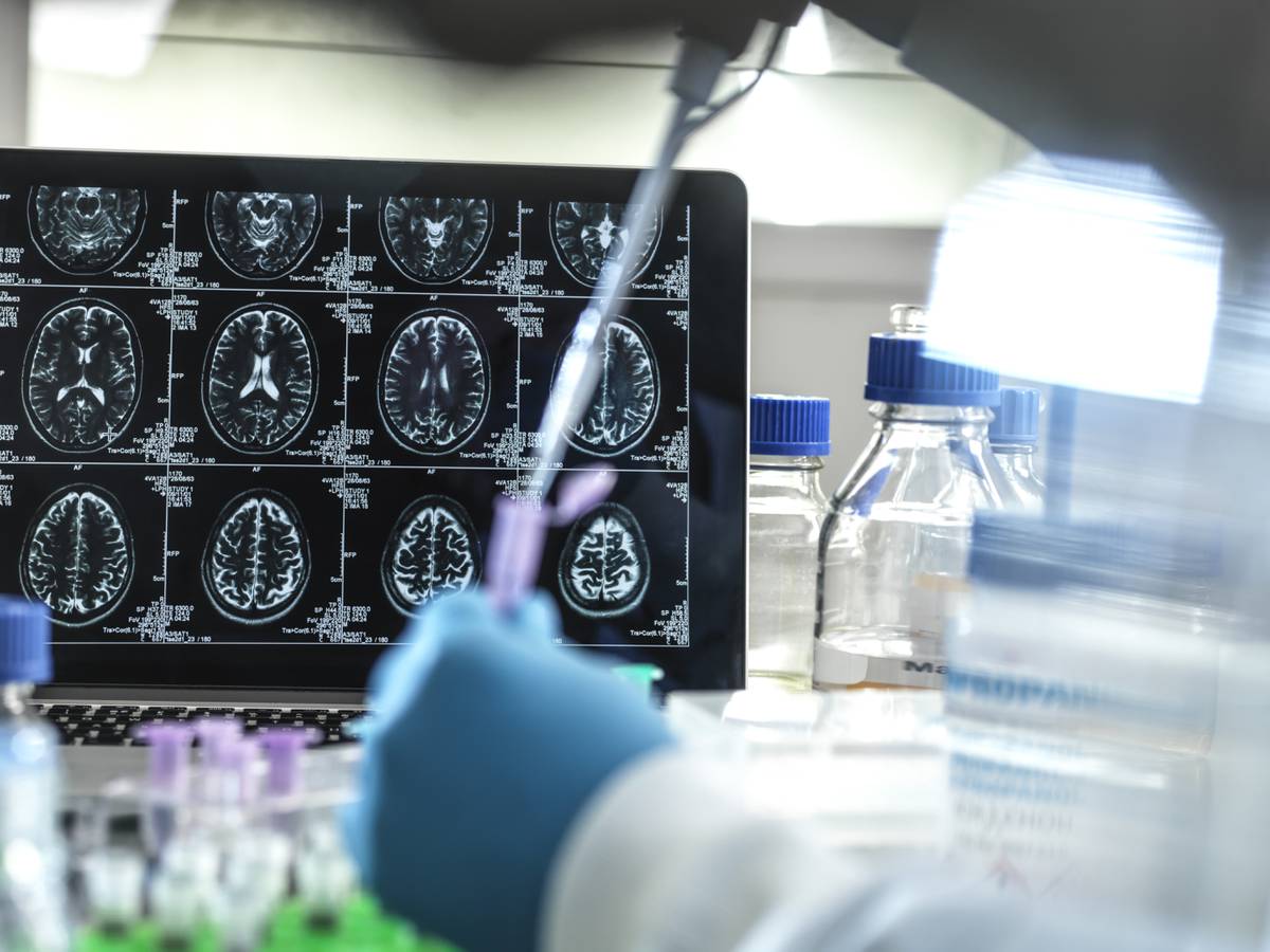 Investigadores trabajando en nuevos tratamientos contra el alzhéimer