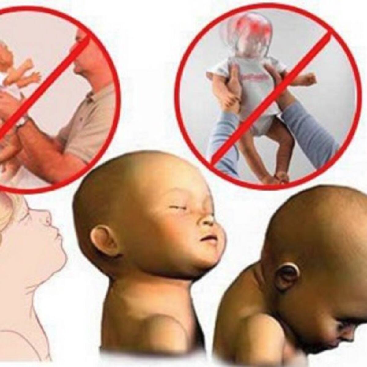 La Policía investiga si había maltrato previo en el caso de la bebé zarandeada de Murcia