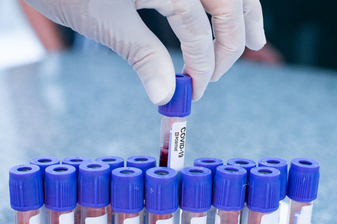 Muestras de sangre para realizar pruebas de COVID-19 en un laboratorio.